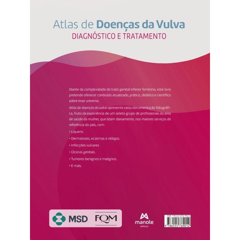 Considerações gerais sobre problemas do ciclo menstrual - Problemas de  saúde feminina - Manual MSD Versão Saúde para a Família