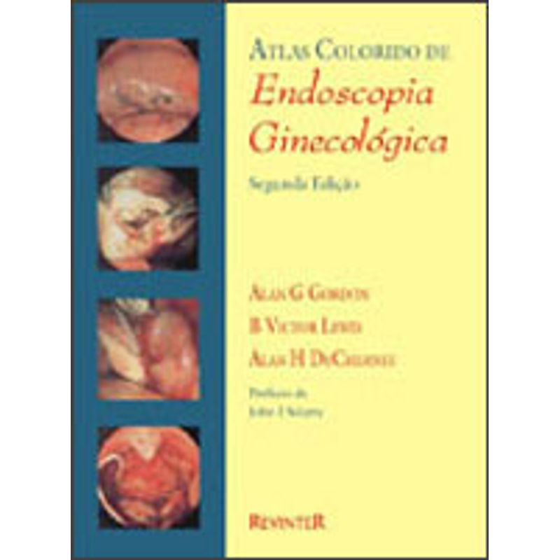 Endoscopia Ginecológica